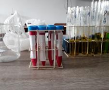 Alunos aprendem na prática como laboratórios realizam testes para determinação de fator Rh e sistema ABO